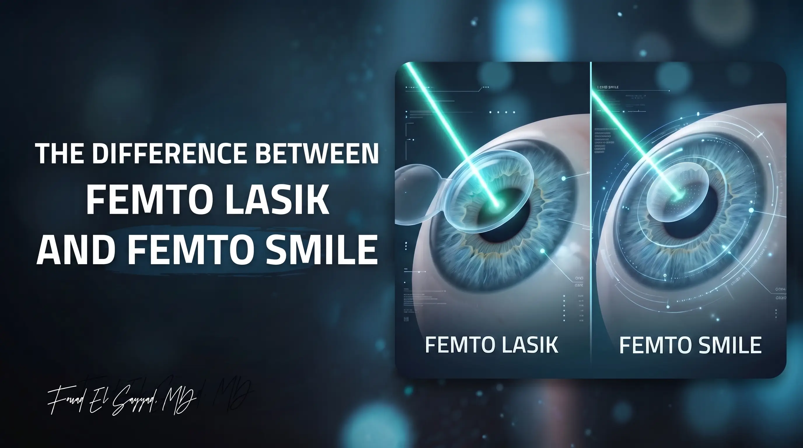 Femto-LASIK vs SMILE Pro (Femto-SMILE): Which Is Right for You?