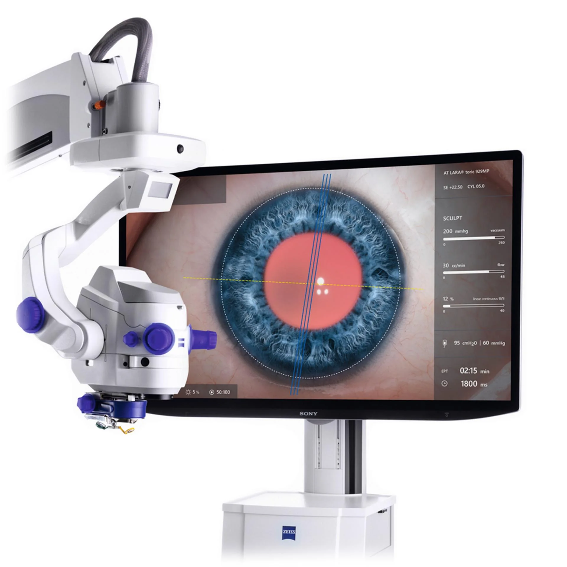 Cataract Surgery Success Rate