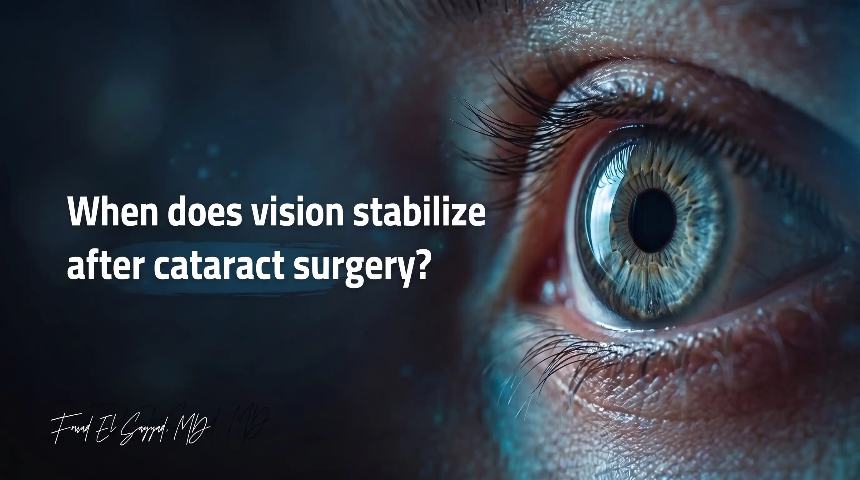 When Does Vision Stabilise After Cataract Surgery? Glasses and Timing