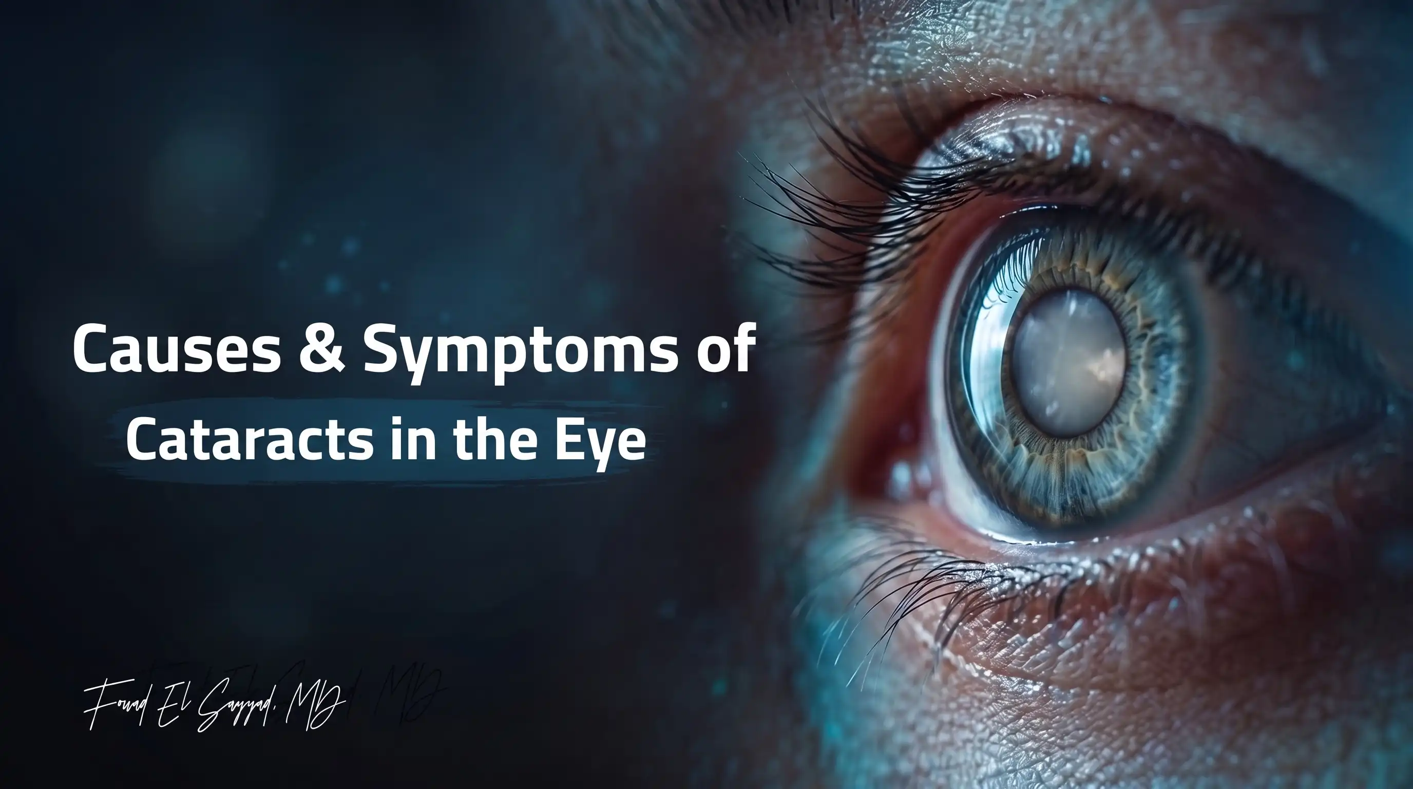 Cataract Causes and Symptoms: Early Signs and Who Is at Risk
