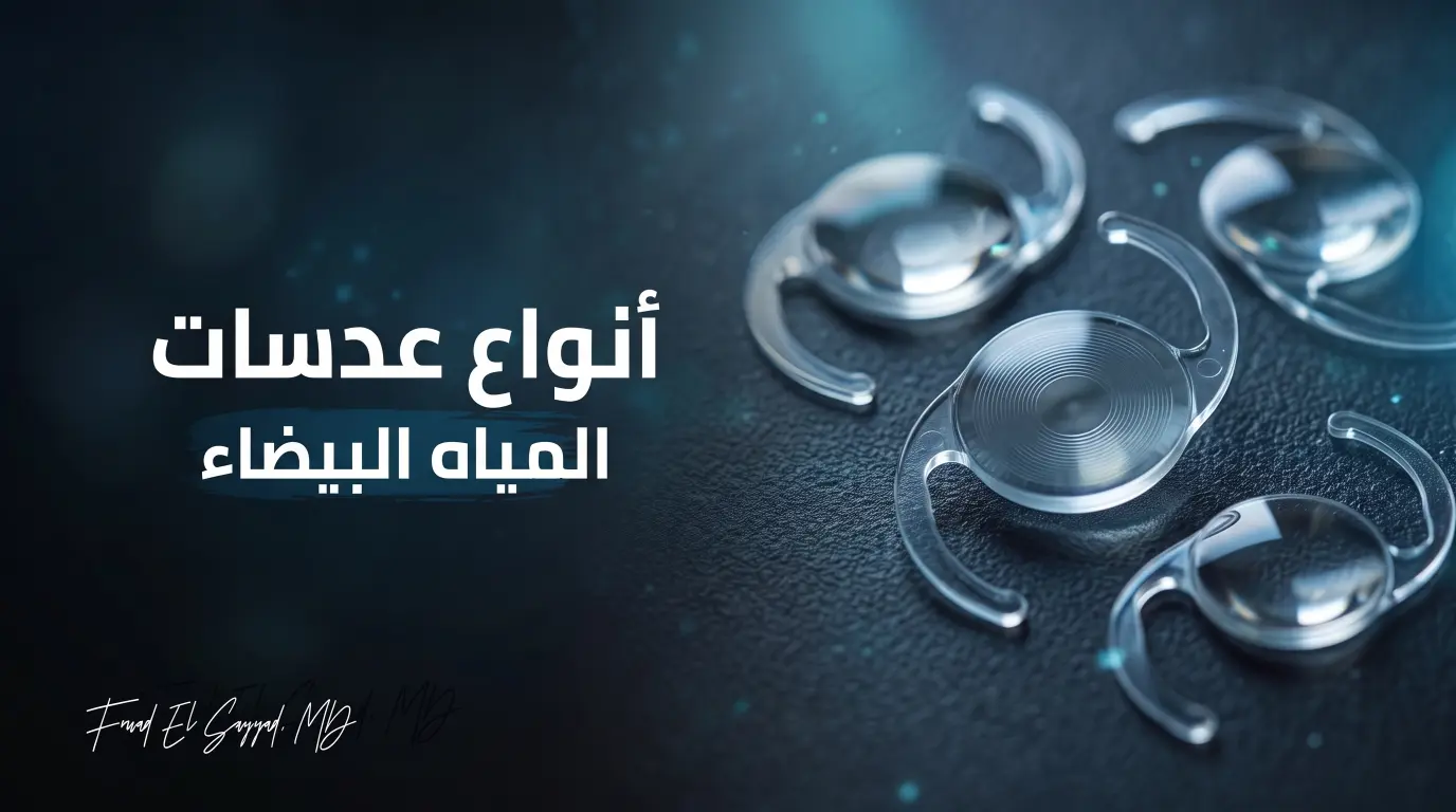 أنواع عدسات المياه البيضاء