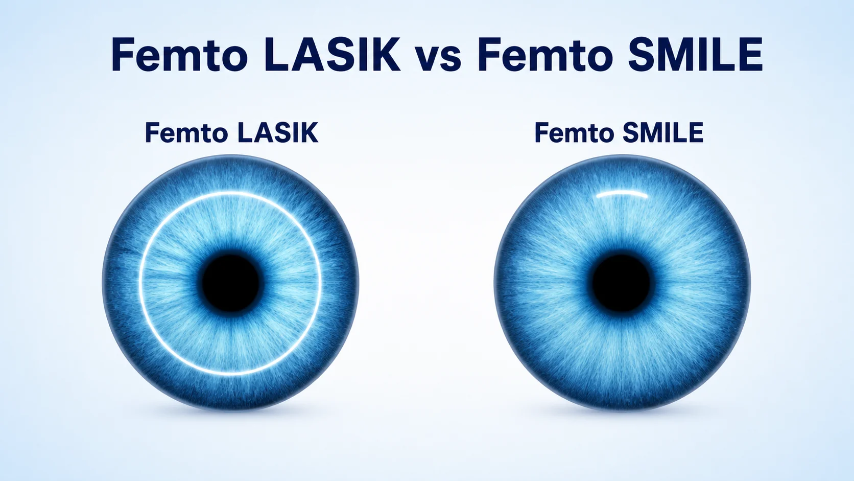 The difference between Femto-LASIK and Femto-SMILE.