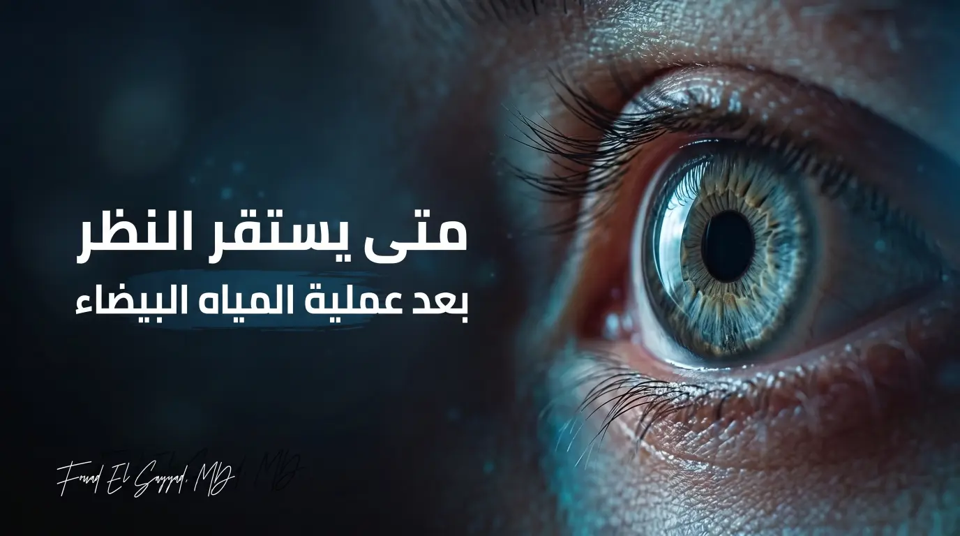 متى يستقر النظر بعد عملية المياه البيضاء