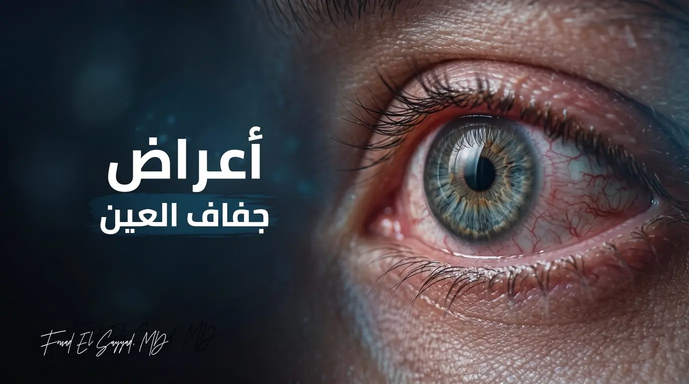 أعراض جفاف العين