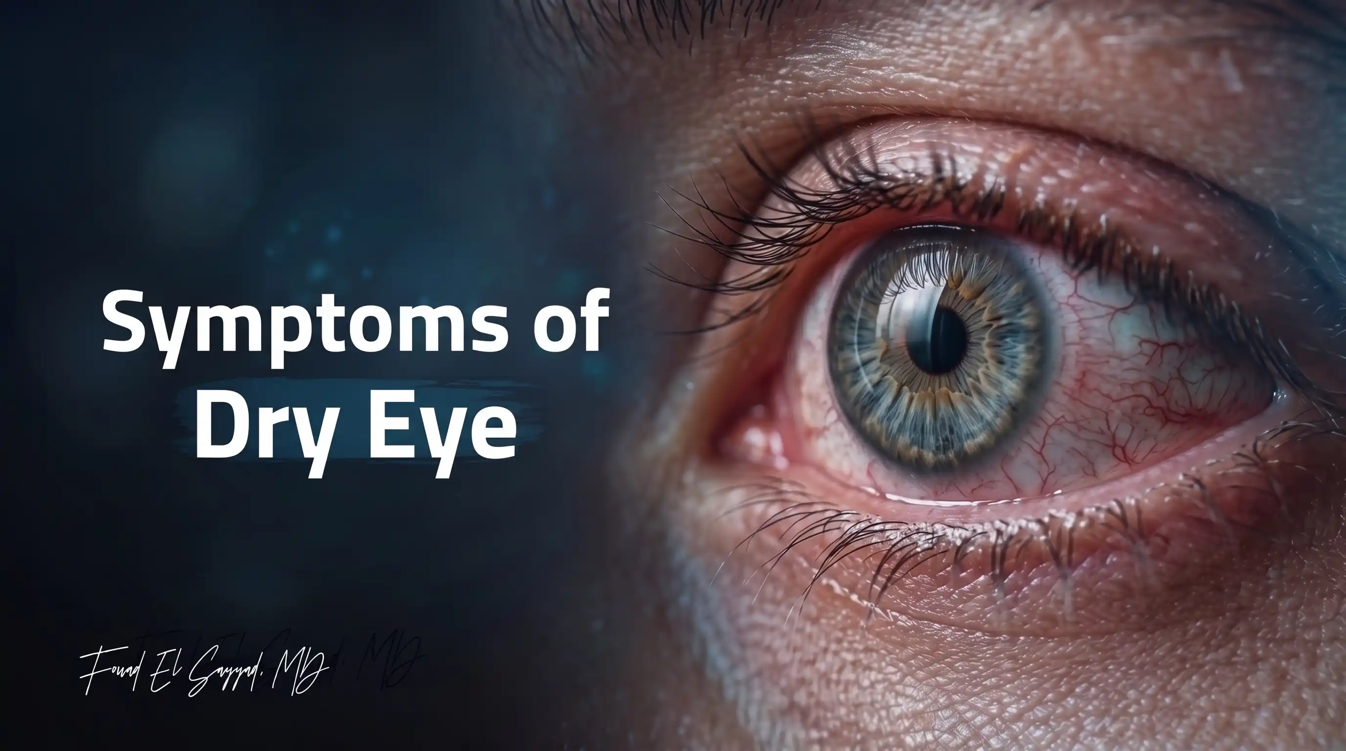 Symptoms of dry eyes